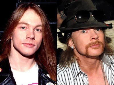 axl-rose-guns-n-roses-roqueiros-famosos-antes-e-depois-rock-na-veia