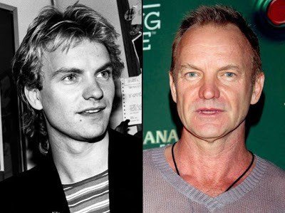 sting-the-police-roqueiros-famosos-antes-e-depois-rock-na-veia