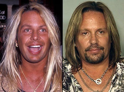 vince-neil-motley-crue-roqueiros-famosos-antes-e-depois-rock-na-veia